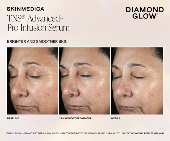 SkinMedica TNS Advanced Plus serum before and after results showing improved skin texture and brightness over 8 weeks with DiamondGlow treatment